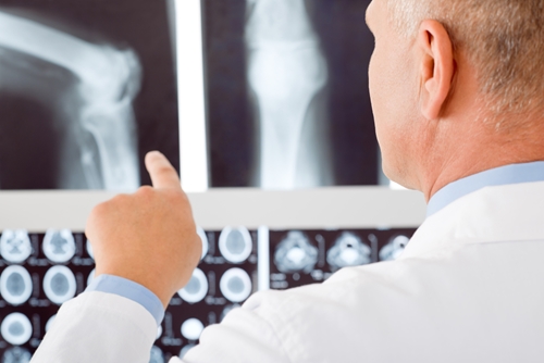 doctor in lab coat points at x-ray of knee