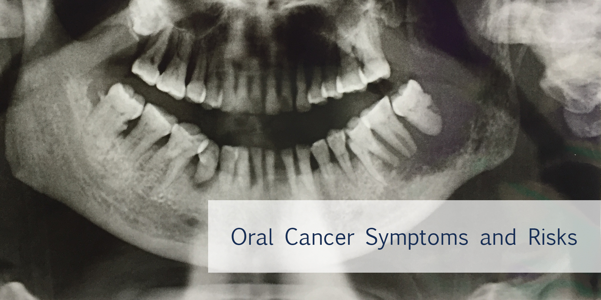 oral cancer