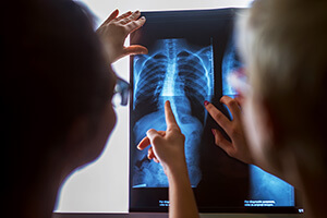 Two people looking at an x-ray