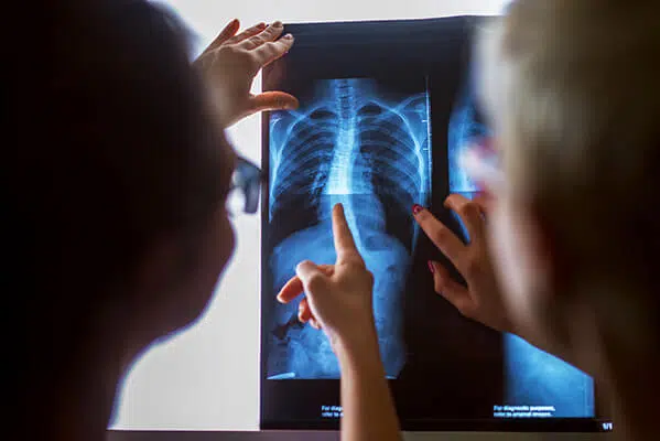 looking at xray