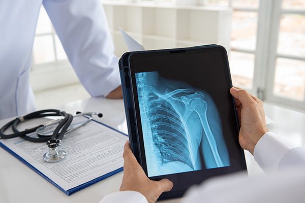 dr holding xray